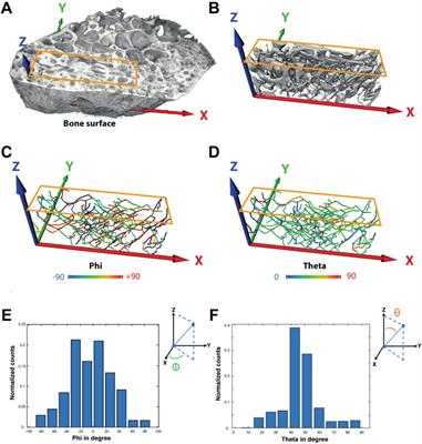 Comparison of the 3D-Microstructure Between Alveolar and Iliac Bone for Enhanced Bioinspired Bone Graft Substitutes